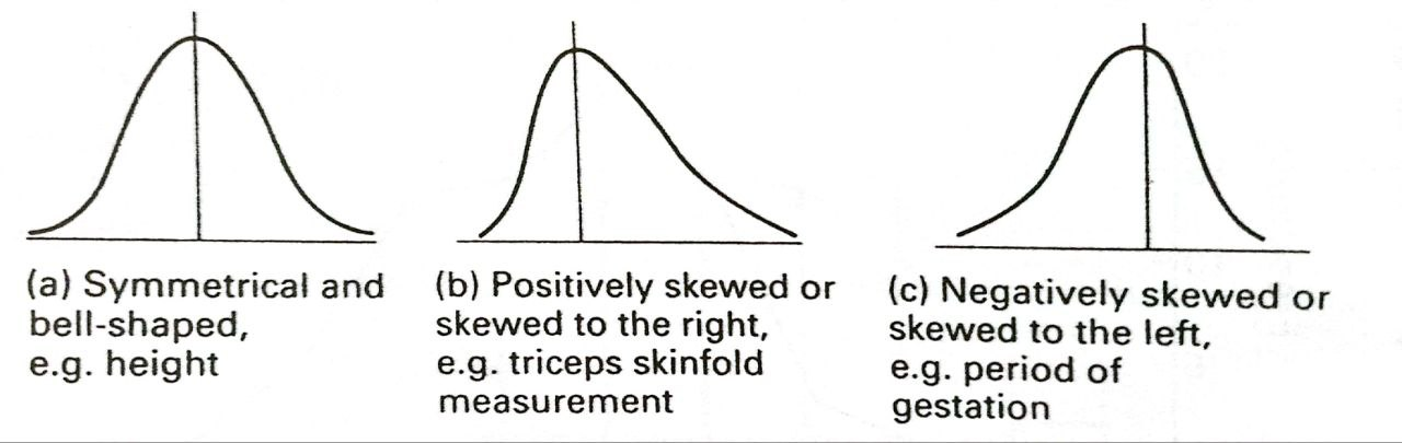 Figure 2.6 - Three common shapes of frequency distributions with an example of each.